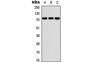 Western blot analysis of PKR expression in THP1 (A), NS-1 (B), PC12 (C) whole cell lysates.