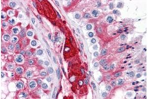 Human Testis: Formalin-Fixed, Paraffin-Embedded (FFPE) (WDR35 抗体  (N-Term))