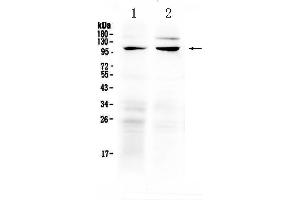 Western blot analysis of TRPC6 using anti-TRPC6 antibody . (TRPC6 抗体  (AA 771-875))
