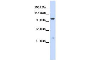 WB Suggested Anti-TRPC4 Antibody Titration:  0. (TRPC4 抗体  (Middle Region))