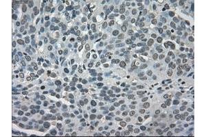 Image no. 2 for anti-Lactate Dehydrogenase A (LDHA) antibody (ABIN1499114) (Lactate Dehydrogenase A 抗体)