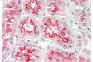 Rabbit Anti-ARSE antibody  Formalin Fixed Paraffin Embedded Tissue: Human Kidney Primary antibody Concentration: 1:100 Secondary Antibody: Donkey anti-Rabbit-Cy3 Secondary Antibody Concentration: 1:200 Magnification: 20x Exposure Time: 0. (Arylsulfatase E 抗体  (Middle Region))