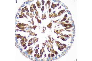 Immunohistochemistry of paraffin-embedded Rat testis using C Rabbit pAb (ABIN7266547) at dilution of 1:100 (40x lens). (CAND2 抗体  (AA 850-1000))