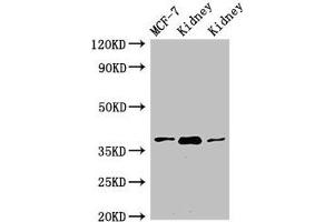 Western Blot Positive WB detected in: MCF-7 whole cell lysate, Rat kidney tissue, Mouse kidney tissue All lanes: HAO2 antibody at 3 μg/mL Secondary Goat polyclonal to rabbit IgG at 1/50000 dilution Predicted band size: 39, 41 kDa Observed band size: 39 kDa (Hydroxyacid Oxidase 2 (HAO2) (AA 2-200) 抗体)