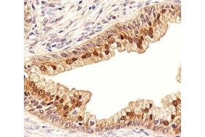 Immunohistochemistry (IHC) image for anti-Isocitrate Dehydrogenase 1 (NADP+), Soluble (IDH1) (AA 116-143) antibody (ABIN3031506)