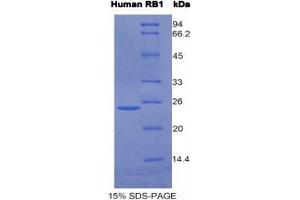 SDS-PAGE analysis of Human RB1 Protein. (Retinoblastoma 1 Protein (RB1))