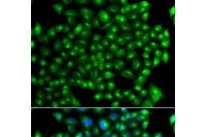 Immunofluorescence analysis of A549 cells using ZFYVE1 Polyclonal Antibody (ZFYVE1 抗体)