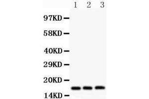 Western Blotting (WB) image for anti-Fragile Histidine Triad (FHIT) (AA 1-147) antibody (ABIN3042392) (FHIT 抗体  (AA 1-147))