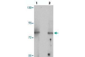 Western blot analysis of UHRF1BP1 in mouse kidney tissue with UHRF1BP1 polyclonal antibody  at (lane 1) 1 and (lane 2) 2 ug/mL.