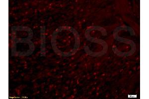 Formalin-fixed and paraffin-embedded rat colitis labeled with Anti-APOA2 Polyclonal Antibody, Unconjugated (ABIN708686) 1:200, overnight at 4°C, The secondary antibody was Goat Anti-Rabbit IgG, Cy3 conjugated used at 1:200 dilution for 40 minutes at 37°C. (APOA2 抗体  (AA 24-100))