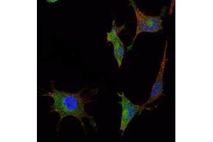 Immunofluorescence analysis of NTERA-2 cells using SMAD5 mouse mAb (green). (SMAD5 抗体)