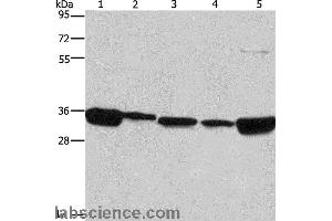 Western blot analysis of 293T, A431, NIH/3T3, hela and hepG2 cell, using ELAVL1 Polyclonal Antibody at dilution of 1:667 (ELAVL1 抗体)