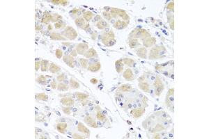 Immunohistochemistry of paraffin-embedded human stomach using MSMB antibody (ABIN6003799) at dilution of 1/100 (40x lens). (MSMB 抗体)