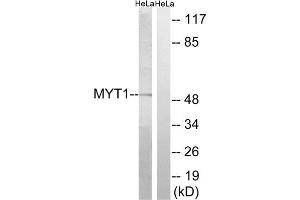 Western blot analysis of extracts from HeLa cells, using MYT1 (epitope around residue 83) antibody. (MYT1 抗体  (Ser83))