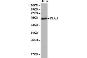 Western Blotting (WB) image for anti-Plasminogen Activator, Urokinase (PLAU) (AA 20-180) antibody (ABIN6219409) (PLAU 抗体  (AA 20-180))