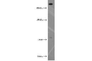 Western Blotting (WB) image for anti-Xin Actin-Binding Repeat Containing 2 (XIRP2) antibody (ABIN2906145) (XIRP2 抗体)