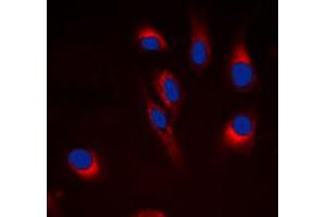Immunofluorescent analysis of Cytochrome P450 21A2 staining in Hela cells. (CYP21A2 抗体  (Center))