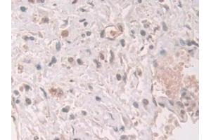 Immunohistochemistry (IHC) image for anti-Grancalcin, EF-Hand Calcium Binding Protein (GCA) (AA 1-139) antibody (ABIN7444166)