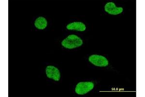 Immunofluorescence of monoclonal antibody to ATF2 on HeLa cell. (ATF2 抗体)