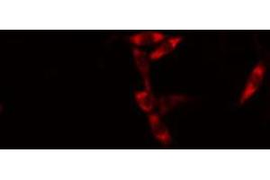 ABIN6274586 staining HuvEc cells by IF/ICC. (AIM2 抗体  (Internal Region))