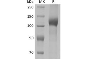 Western Blotting (WB) image for Leptin Receptor (LEPR) protein (His tag) (ABIN7320898)