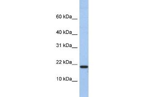 WB Suggested Anti-C1D Antibody Titration:  0. (C1D 抗体  (N-Term))