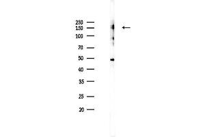 Western blot analysis of lysates from K562 cells(heat-shock 45 min treatment), using Phospho-JAK2 (Tyr1007/Tyr1008) Antibody at 1/1000 dilution.