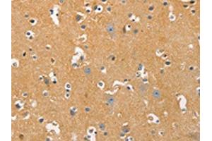 The image on the left is immunohistochemistry of paraffin-embedded Human brain tissue using ABIN7129239(DNM3 Antibody) at dilution 1/20, on the right is treated with fusion protein. (Dynamin 3 抗体)