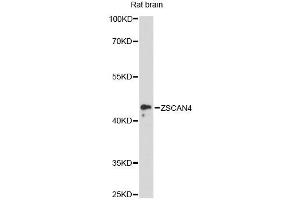 Western blot analysis of extracts of rat brain, using ZSCAN4 antibody (ABIN6293838) at 1:3000 dilution. (ZSCAN4 抗体)