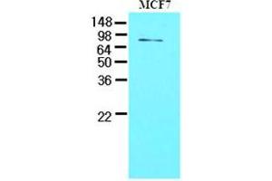 Western Blotting (WB) image for anti-Tyrosyl-DNA Phosphodiesterase 1 (TDP1) (AA 1-298), (N-Term) antibody (ABIN400858) (TDP1 抗体  (N-Term))