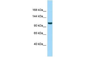 WB Suggested Anti-ITIH5 Antibody Titration: 1. (ITIH5 抗体  (N-Term))