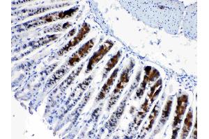 IHC analysis of CD166/ALCAM using anti- CD166/ALCAM antibody . (CD166 抗体  (AA 167-406))