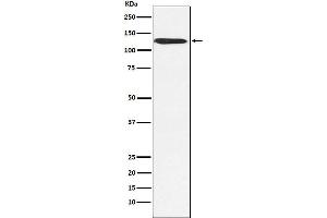 Western blot analysis of SNF2H expression in MCF7 cell lysate.