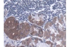 DAB staining on IHC-P; Samples: Human Stomach Tissue (Dystonin 抗体  (AA 1-252))