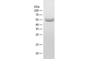 Western Blotting (WB) image for Stress-Induced-phosphoprotein 1 (STIP1) (AA 1-543) protein (His tag) (ABIN7287546) (STIP1 Protein (AA 1-543) (His tag))