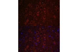 Immunofluorescence analysis of mouse brain using RUSC1 antibody (ABIN7270114) at dilution of 1:100. (RUSC1 抗体  (AA 1-320))
