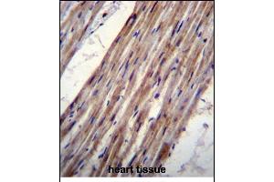 KCNJ8 Antibody (N-term) (ABIN656236 and ABIN2845552) immunohistochemistry analysis in formalin fixed and paraffin embedded human heart tissue followed by peroxidase conjugation of the secondary antibody and DAB staining. (KCNJ8 抗体  (N-Term))