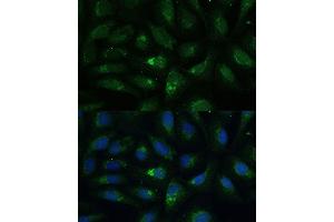 Immunofluorescence analysis of U-2 OS cells using  Polyclonal Antibody (ABIN7265509) at dilution of 1:100 (40x lens). (AEBP1 抗体  (AA 999-1158))