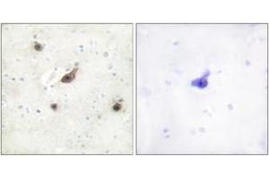Immunohistochemistry analysis of paraffin-embedded human brain tissue, using B-RAF Antibody. (SNRPE 抗体  (AA 171-220))