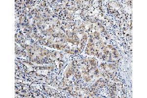 IHC analysis of ALDH6A1 using anti-ALDH6A1 antibody (ABIN7602810).