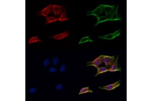 ABIN6258536 and ABIN6274873 staining Hela cells by IF/ICC.