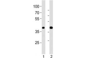 Western blot analysis of lysate from 1) mouse pancreas and 2) rat pancreas tissue using PDX1 antibody at 1:1000. (PDX1 抗体  (N-Term))