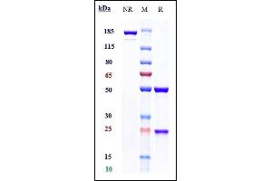 Anti-FGFR3 / CD333 Reference Antibody (vofatamab) on SDS-PAGE under reducing (R) condition. (Recombinant FGFR3 (Vofatamab Biosimilar) 抗体)