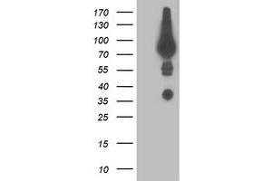 Western Blotting (WB) image for anti-Dipeptidyl-Peptidase 3 (DPP3) antibody (ABIN1497832) (DPP3 抗体)