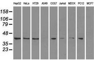 Western blot analysis of extracts (35 µg) from 9 different cell lines by using anti-MAPK1 monoclonal antibody. (ERK2 抗体)