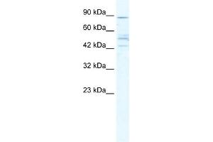 WB Suggested Anti-CHRNB2 Antibody Titration:  5. (CHRNB2 抗体  (Middle Region))