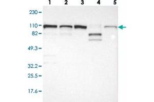 Western blot analysis of Lane 1: RT-4, Lane 2: U-251 MG, Lane 3: A-431, Lane 4: Liver, Lane 5: Tonsil with CTAGE5 polyclonal antibody .