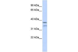 WB Suggested Anti-HYLS1 Antibody Titration: 0. (HYLS1 抗体  (Middle Region))
