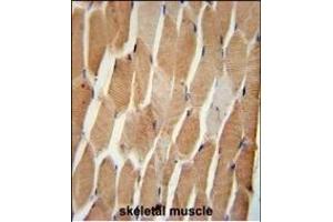 COQ7 Antibody (C-term) (ABIN652061 and ABIN2840529) immunohistochemistry analysis in formalin fixed and paraffin embedded human skeletal muscle followed by peroxidase conjugation of the secondary antibody and DAB staining. (Coq7 抗体  (C-Term))