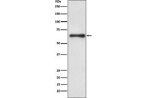 Western blot analysis of Cdc6 expression in Hela cell lysate treated with hydroxyurea.
